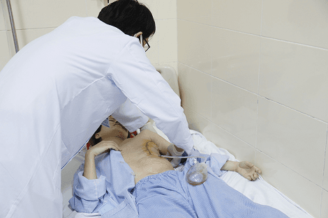 Tái tạo vùng mặt sau tổn thương nghiêm trọng